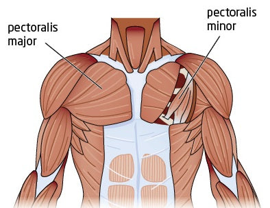 illustration of upper body anatomy highlighting the pectoralis major and pectoralis minor muscles that make up the chest wall.