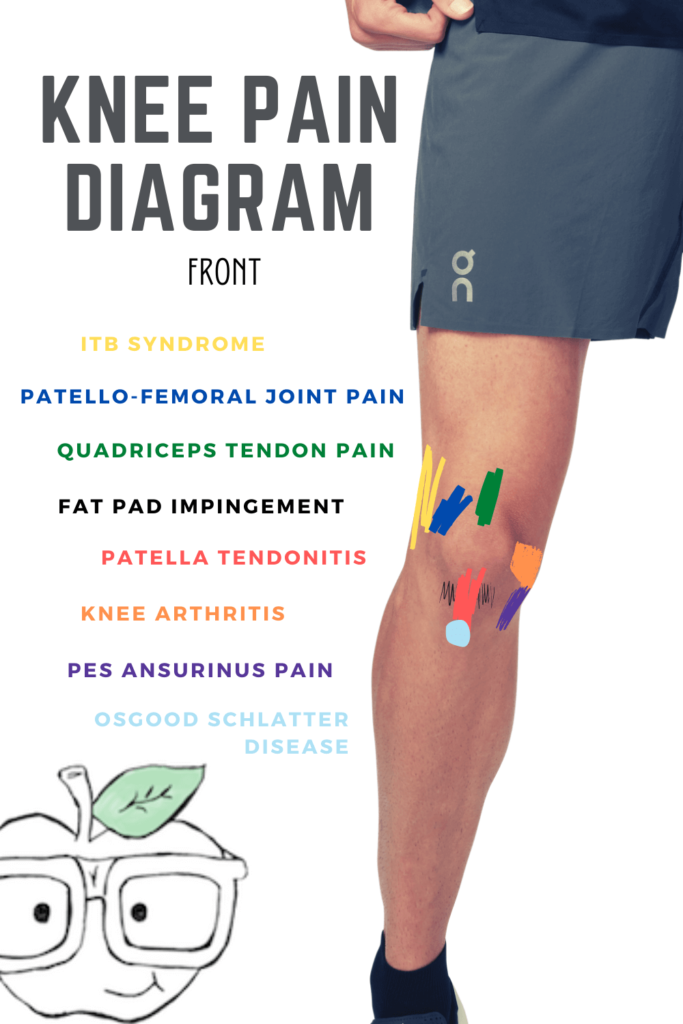 knee pain diagram - itb syndrome, patello-femoral pain, quadriceps tendon, fat pad impingement, patella tendonitis, knee arthritis, pes ansurinus pain, osgood schlatter disease